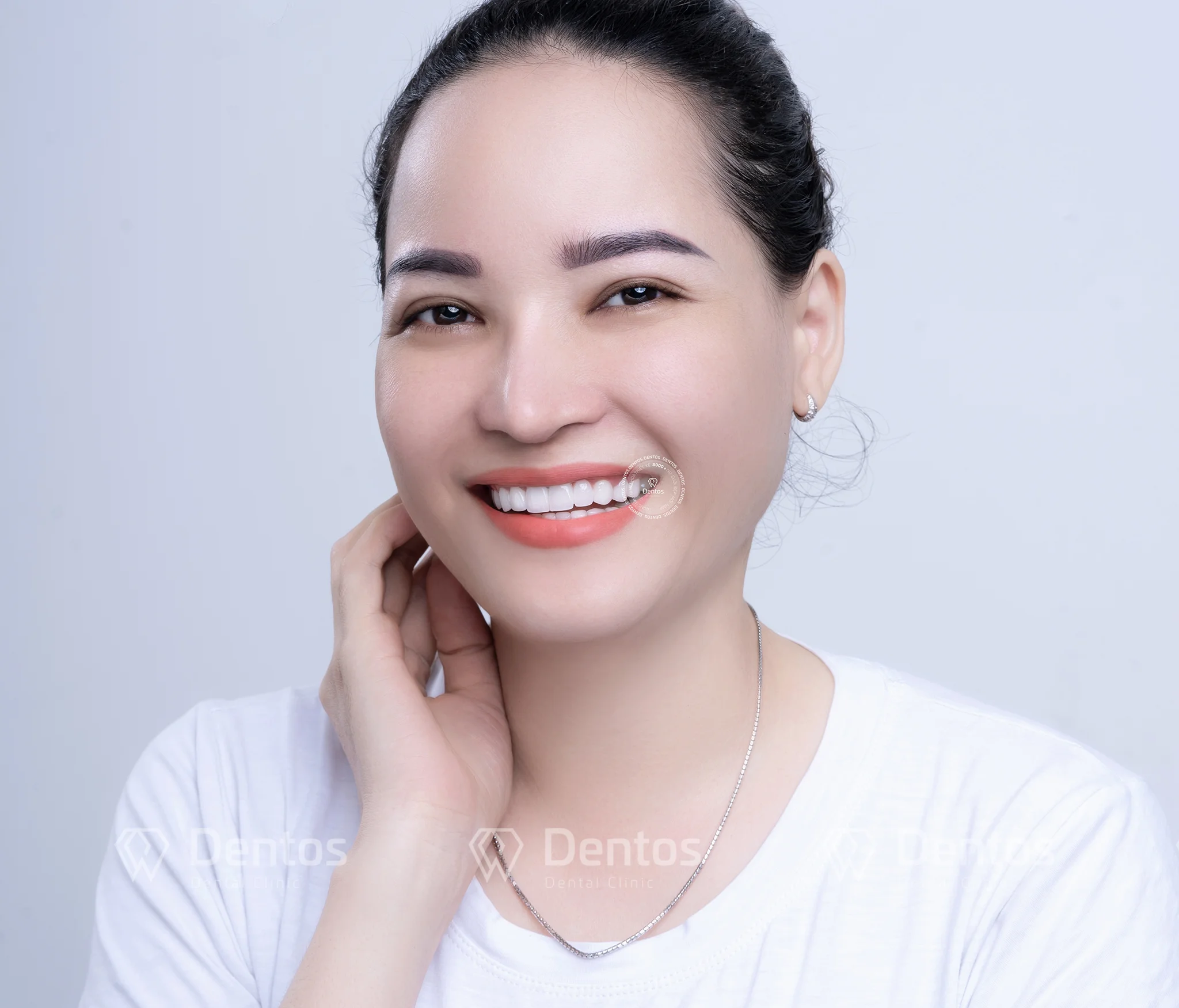 Răng sứ Cercon là dòng sản phẩm Zirconia cao cấp có công nghệ từ Đức